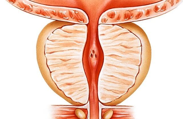 Zapalenie prostaty